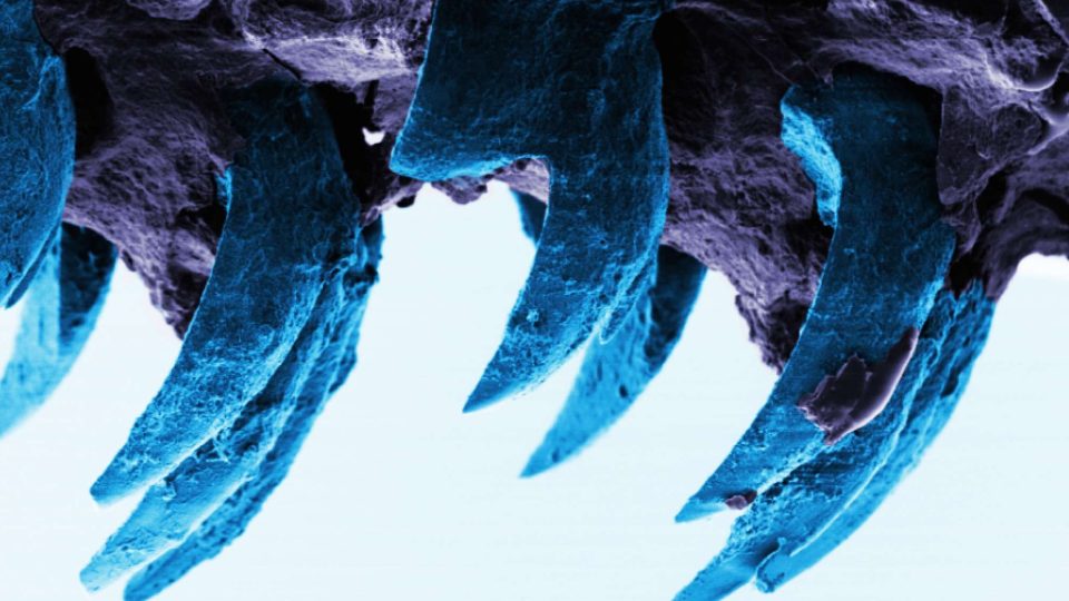 Zuby přílepky na snímku z elektronového mikroskopu