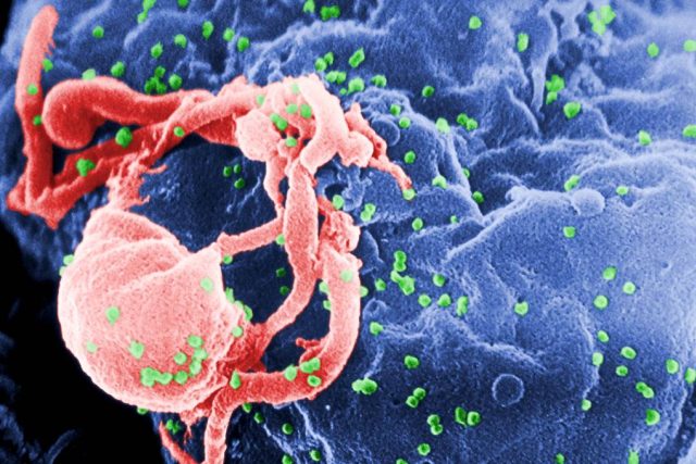 Virus HIV  (zeleně) na kolorovaném snímku z elektronového mikroskopu | foto:  Public Health Image Library
