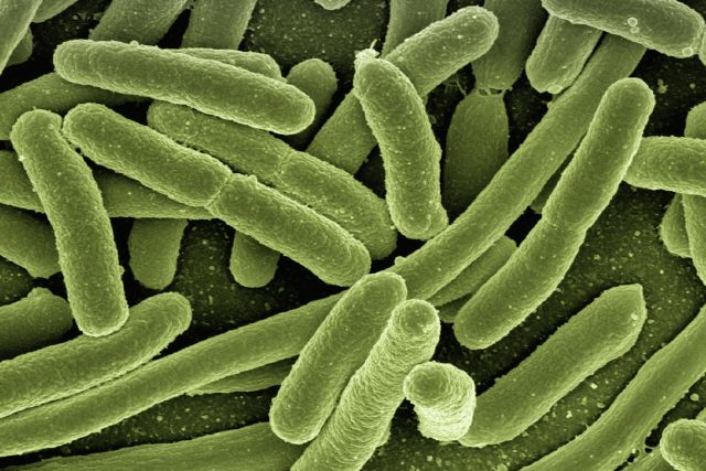Přežije bakterie s umělou DNA? | foto: Gerd Altmann,  Pixabay,  CC0 1.0