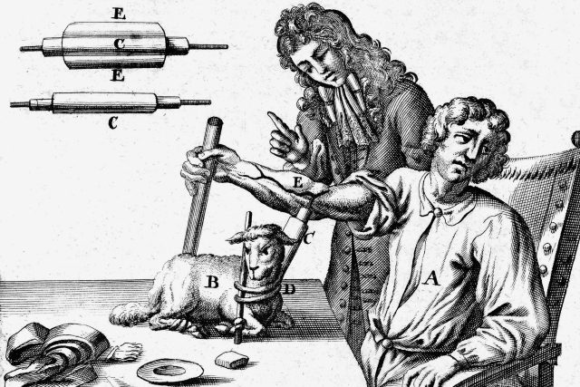 Transfúze krve z beránka do člověka  (Anglie 1667) | foto: Profimedia