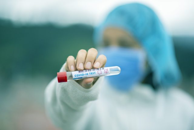 Nové testy na odhalení koronaviru jsou mnohonásobně rychlejší | foto: Fernando Zhiminaicela,  Pixabay