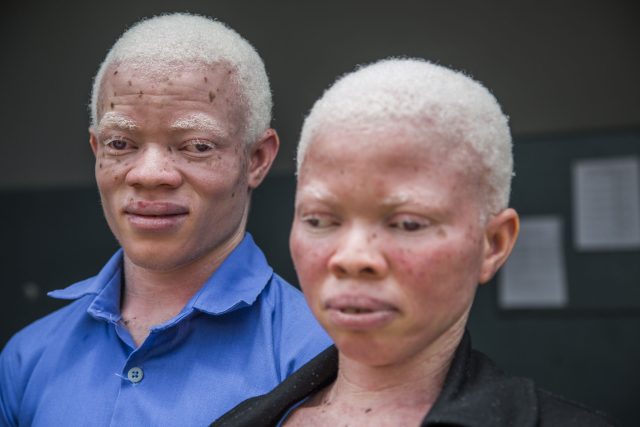 Bílá nosí smrt. Dokument o osudu albínů v africké Ghaně | foto: Lukáš Houdek