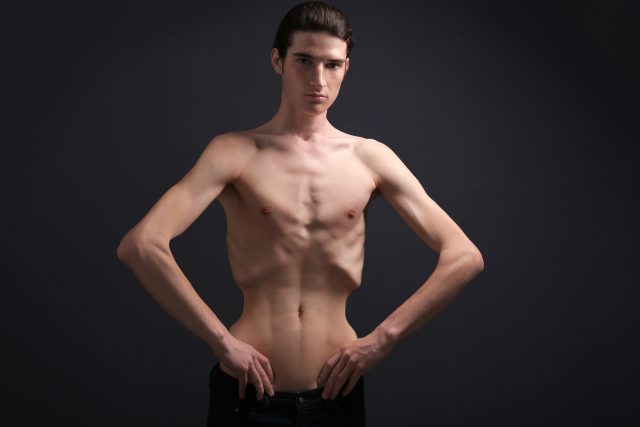 Co je to restriktivní anorexie? Vlastně jde o záměrné a chorobné snižování příjmu potravy | foto: Shutterstock